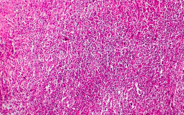 【專業科普】干細胞回輸到體內后都到哪了？