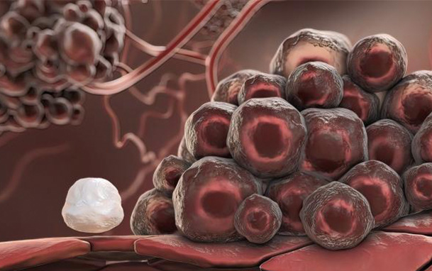 干細(xì)胞與糖尿病